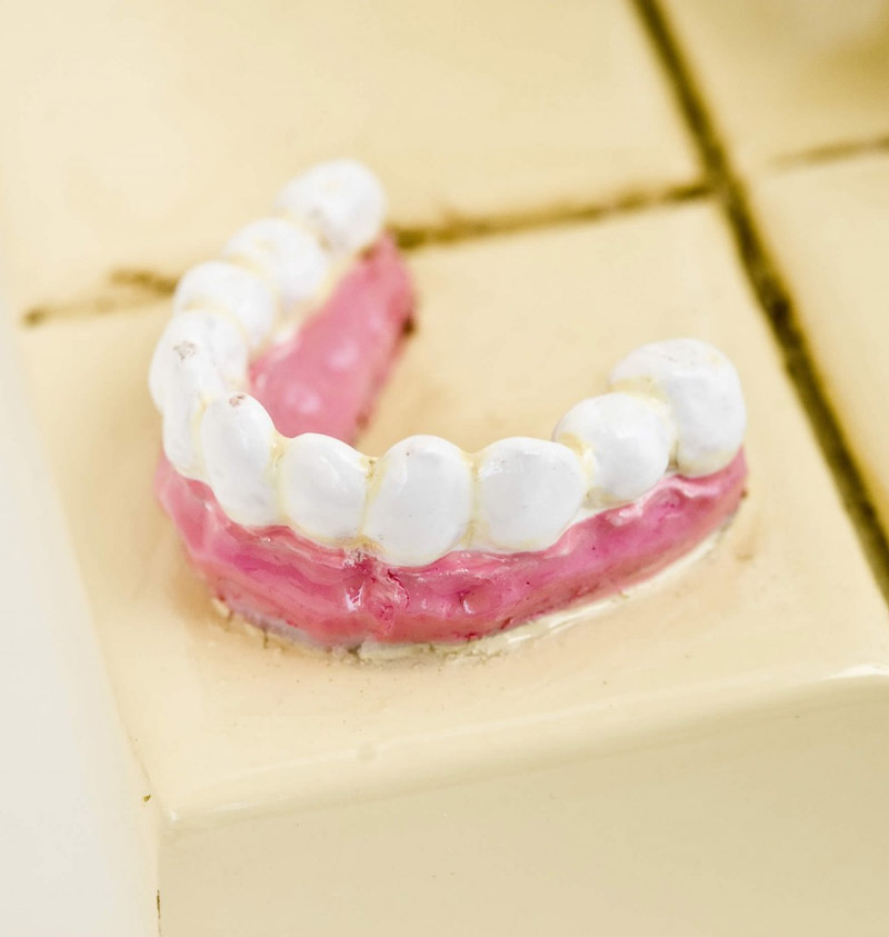 Le Dentiste - Small 21 cm - Guillermo Forchino®